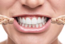 ارتودنسی فوری