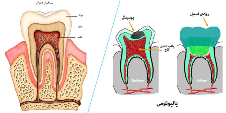 ساختار و ساختمان دندان ها چگونه است؟ + انواع قسمت های دندان - راهنمای ...