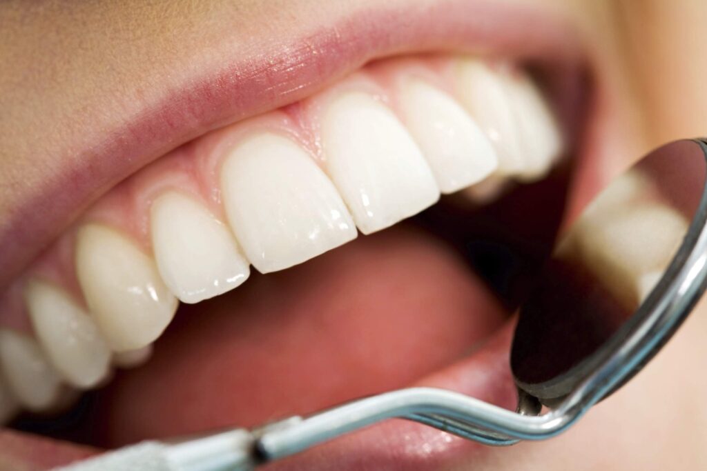 اهمیت حفظ بهداشت دهان برای سفید شدن دندان‌ها