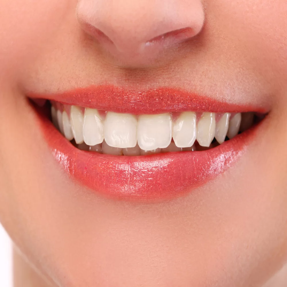  روش سفید کردن دندان