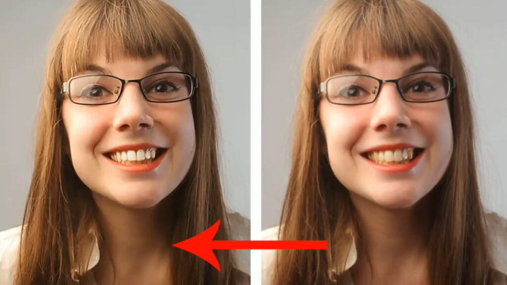 روش سفید کردن دندان‌های زرد با استفاده از پوست موز