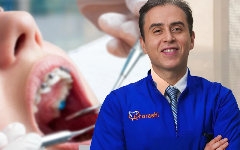 دکتر قریشی، بهترین متخصص ارتودنسی در سعادت آباد