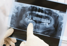 رادیولوژی دندان، فک و صورت در یزد