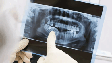 رادیولوژی دندان، فک و صورت در یزد