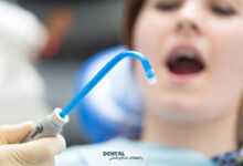 What are the functions and types of dental suction devices?