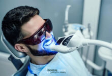 بلیچینگ با روش Zoom Whitening چیست؟