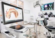 آشنایی با تجهیزات دیجیتال قالبگیری و کاربرد آنها در طراحی لبخند