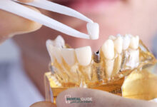 ارتودنسی و ایمپلنت همزمان؛ آیا امکان پذیر است؟