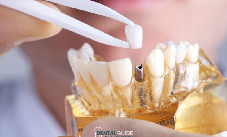 ارتودنسی و ایمپلنت همزمان؛ آیا امکان پذیر است؟
