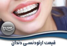قیمت ارتودنسی دندان