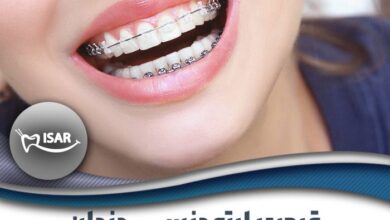قیمت ارتودنسی دندان