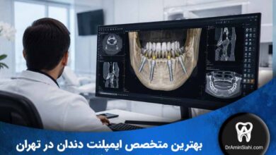 راهنمای انتخاب بهترین متخصص ایمپلنت دندان در تهران با برنامهریزی دیجیتال و تصویربرداری سهبعدی CBCT