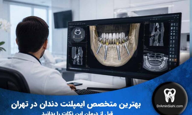راهنمای انتخاب بهترین متخصص ایمپلنت دندان در تهران با برنامهریزی دیجیتال و تصویربرداری سهبعدی CBCT