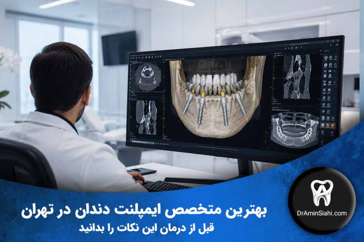 راهنمای انتخاب بهترین متخصص ایمپلنت دندان در تهران با برنامهریزی دیجیتال و تصویربرداری سهبعدی CBCT