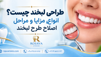طراحی لبخند چیست؟ معرفی انواع روش های اصطلاح لبخند، قیمت