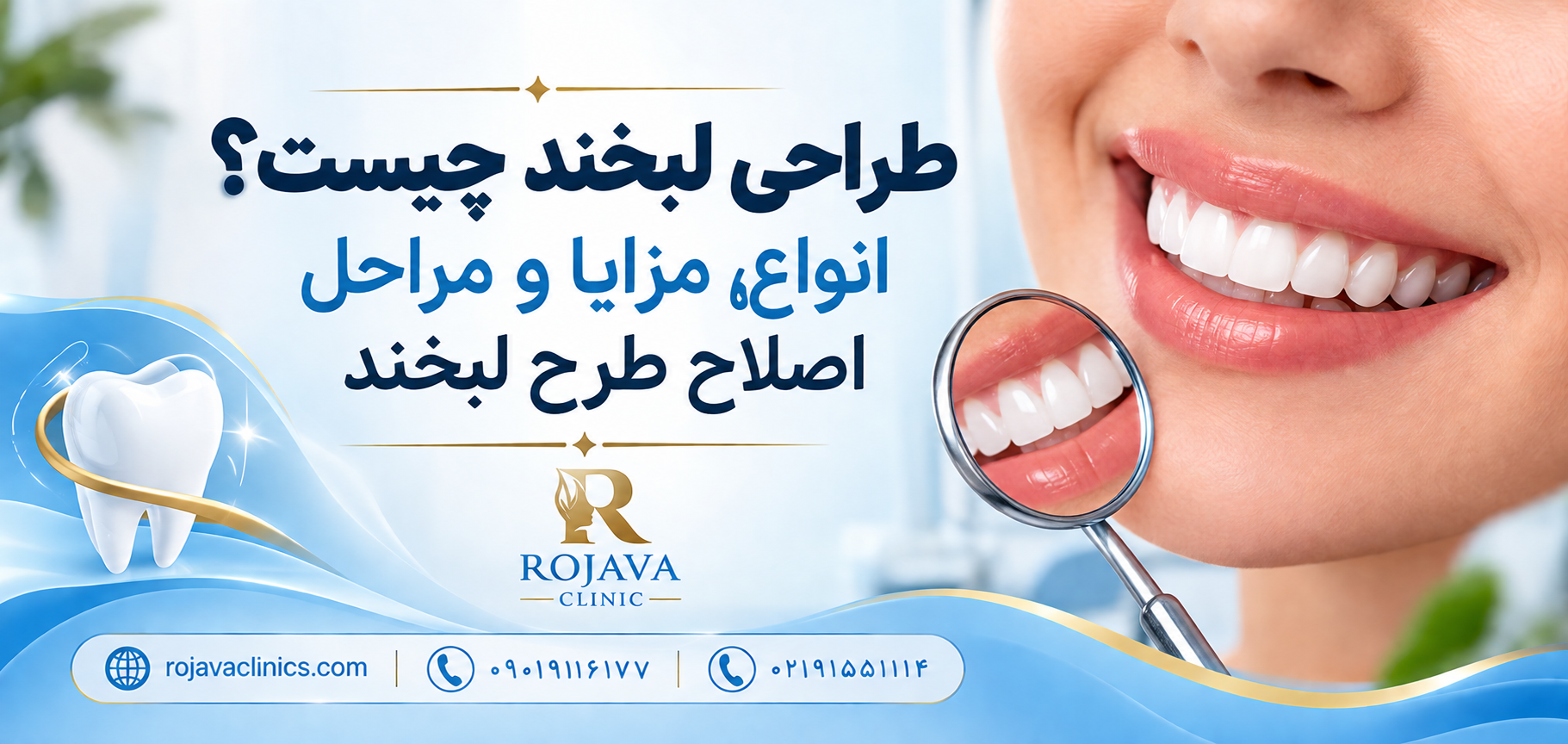 طراحی لبخند چیست؟ معرفی انواع روش های اصطلاح لبخند، قیمت
