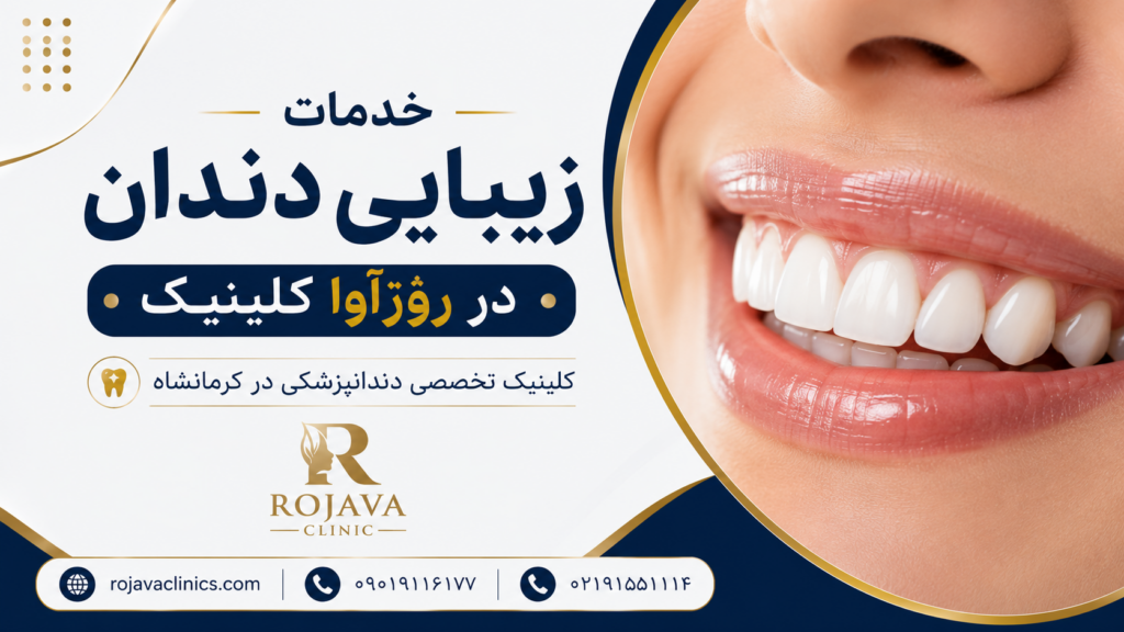 خدمات طرح لبخند در https://rojavaclinics.com کلینیک تخصصی دندانپزشکی در کرمانشاه