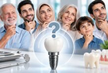 آیا همه افراد میتوانند ایمپلنت دندان انجام دهند