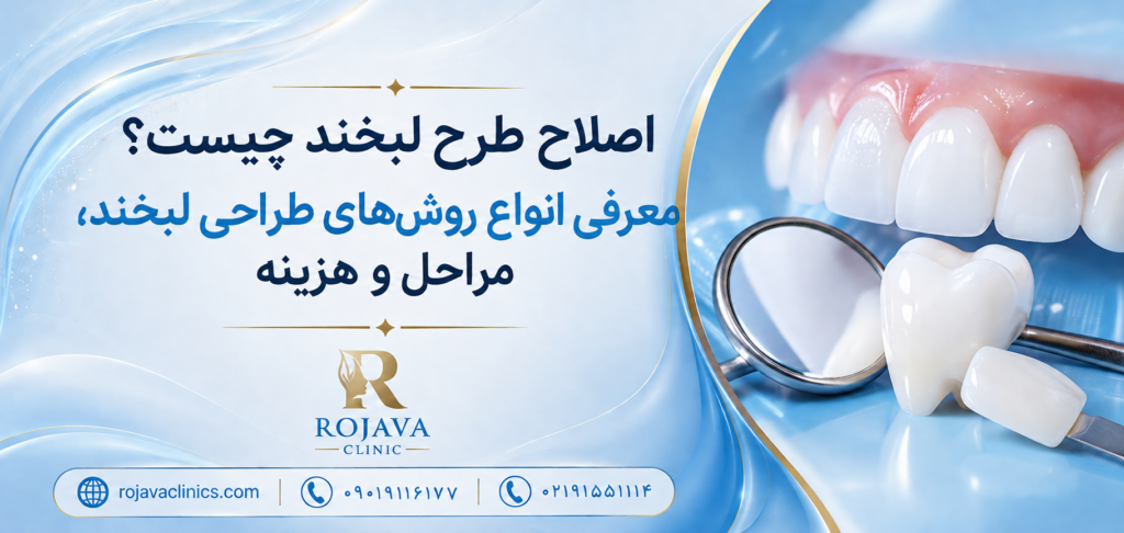 صفر تا صد اصلاح طرح لبخند با روش های مختلف