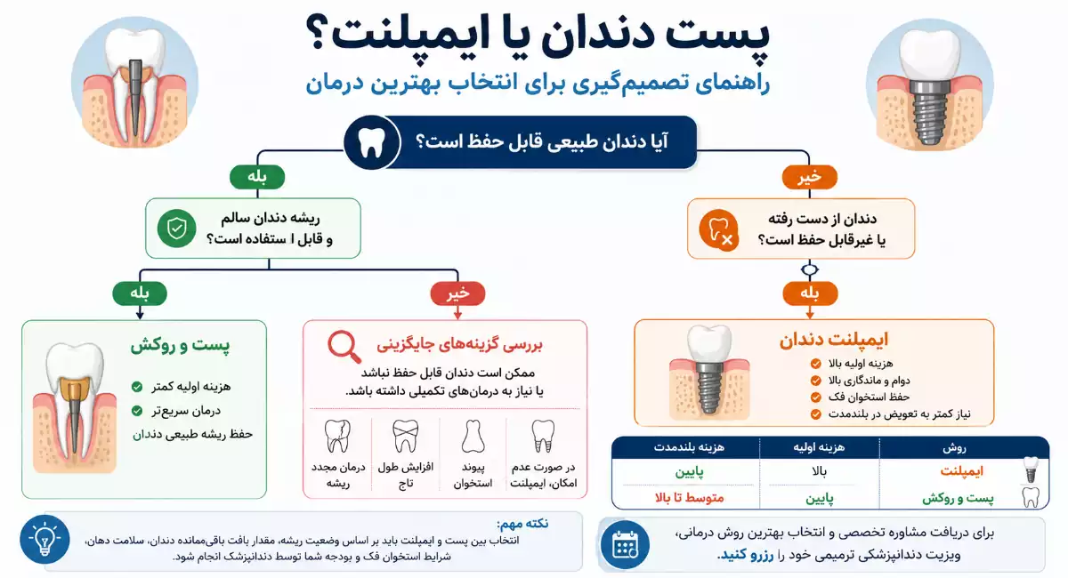 dental-post-or-implant-decision-guide