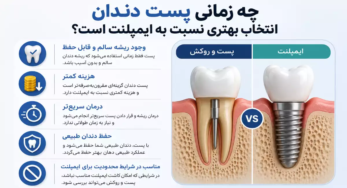 چه زمانی پست و روکش دندان بهتر از ایمپلنت است