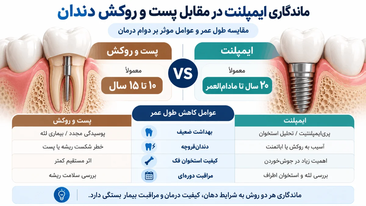 مقایسه ماندگاری ایمپلنت و پست و روکش دندان