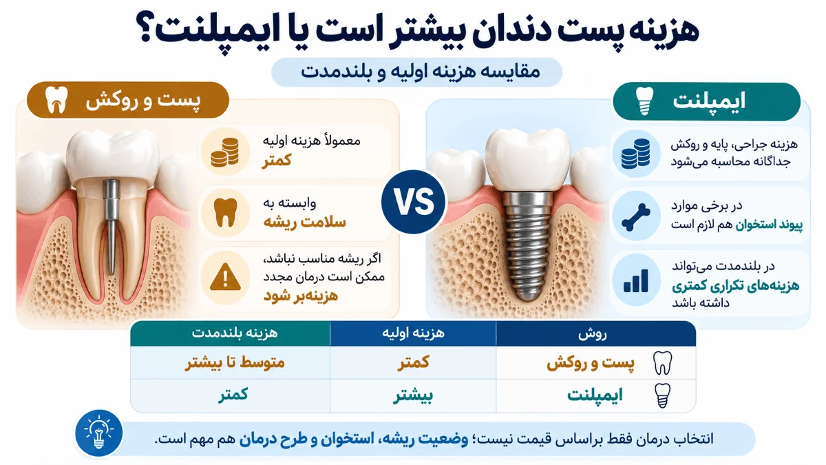 مقایسه هزینه پست و روکش دندان با ایمپلنت